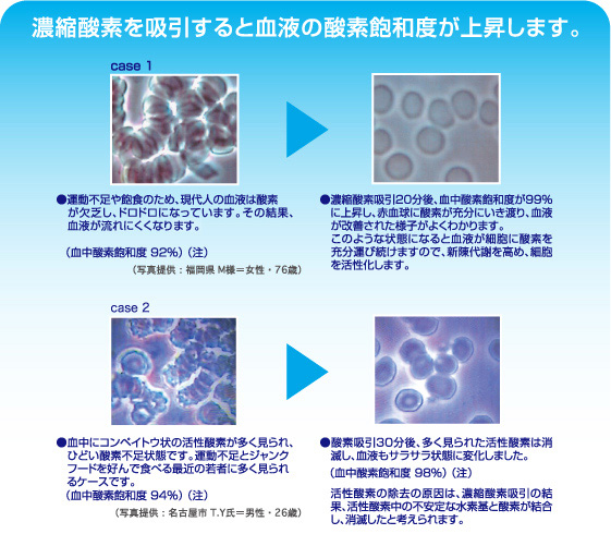 濃縮酸素の効果