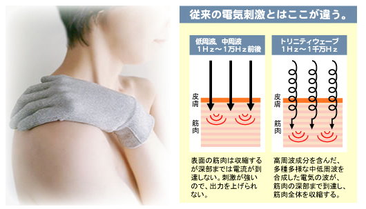 医療機器として認定されるプロテクノの実力を継承